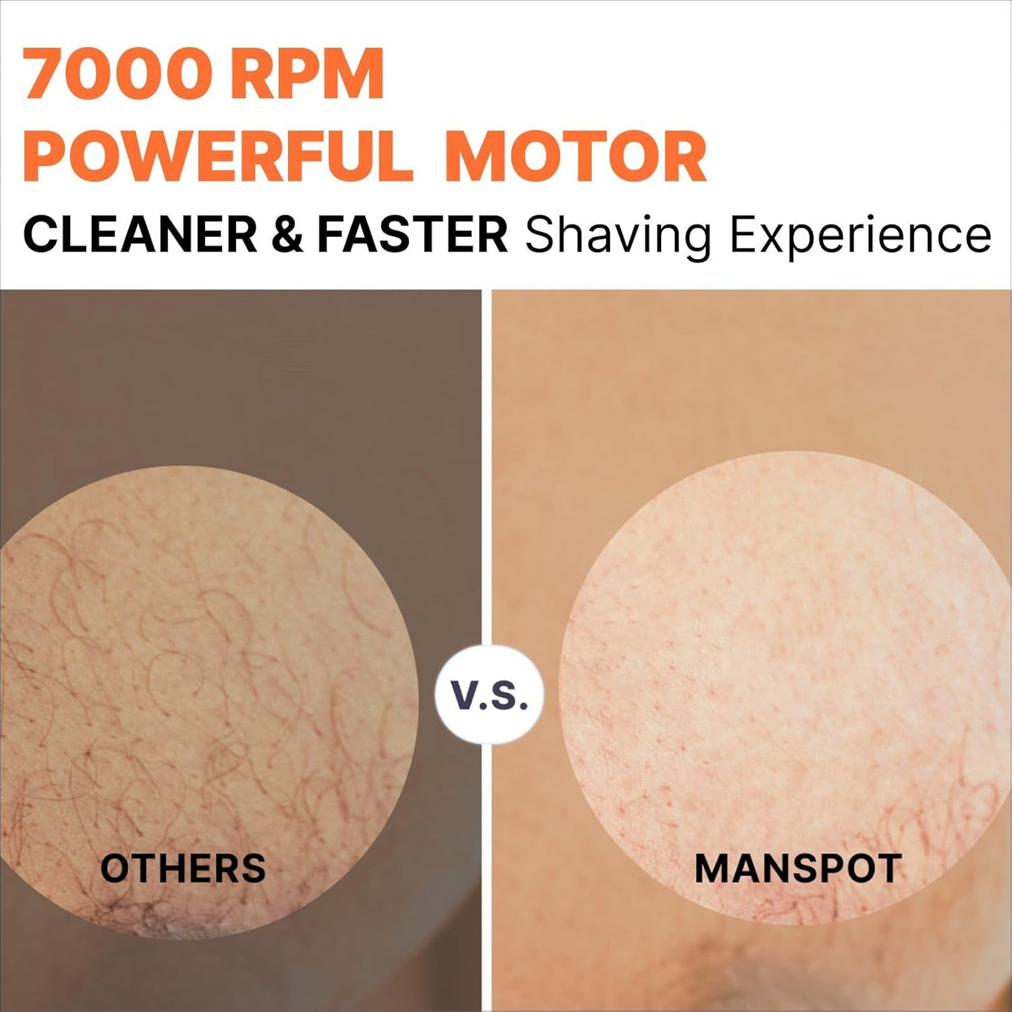 Manscape Groin & Body Hair Trimmer for Men, Electric Ball Pubic Trimmer Shaver,Manscape Kit with 4 Guard,Replaceable Ceramic Blade Heads,Waterproof Wet/Dry Shaver,90 Minutes Shaving